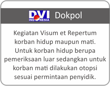 Layanan DVI Dokpol Rumah Sakit Bhayangkara Tingkat III Banjarmasin